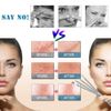 4PCS Blackhead Remover Tool Set Acne Extractor Comedone Pimples Spot and Zit