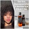 Retinol Face Exfoliant Cleanser/Toner Acne,Spots Hyperpigmentation & Sunburn 2oz