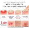 1+1 Elizavecca Acne Cover blemish Spot Patch Hydrocolloid Patches 44+44 = 88 Count (12mm 12 Count, 10mm 8 Count, 8mm 24 Count x 2) / spot patches, Vegan-friendly, Not Tested on Animals, Acne Pimple Patch for Covering Zits and Blemishes, Spot Stickers for 