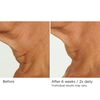 NassifMD Deco-Lift Neck & Decollete Firming & Lifting Complex