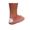 Mueller Self Healing Blister Pads