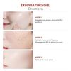Purifying Exfoliating Gel,Face and Body Exfoliating Scrub Gel (2pcs)