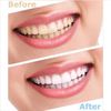 Portable Teeth Whitening Machine Bleaching Accelerator 6 LEDs Cold Light YS-TW-A