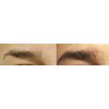 RAPIDBROW Eyebrow Enhancing Serum, 3ml /0.1 Fluid Ounce clear
