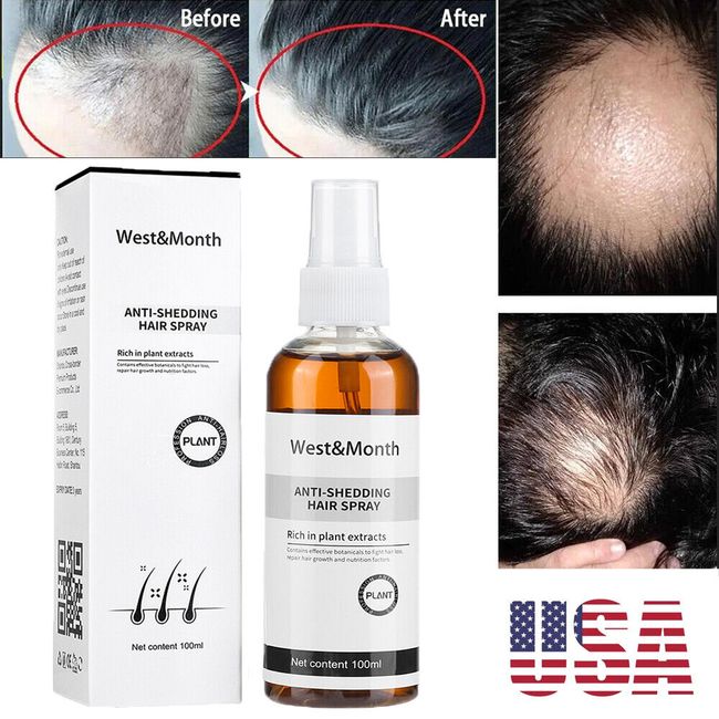 Blusoms Anti-Shedding Hair Spray,Anti Hair Loss Serum Fast Hair Growth Spray US