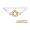 Alcare 18061 Fixed Belt and Fixing Tool for II Storms, 1 Set