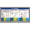 Pro Fitz Thin Compression Supporter for Knees, Size LL (Pro-fits, Compression Athletic Support, Knees, LL)