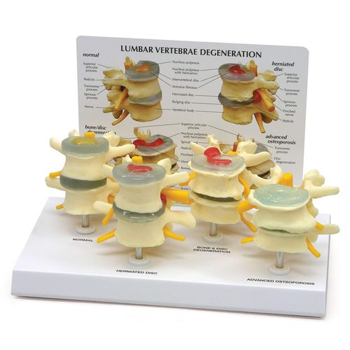 GPI Anatomicals - 4-Stage Vertebrae Model, Spine Model for Human Anatomy and Physiology Education, Anatomy Model for Doctor's Office and Classrooms, Medical Learning Resources