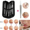 9Pcs Blackhead Extractor Comedone Acne Spot Popper Pimple Remover Tool Kit