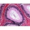 AmScope 40X-2000X Medical Lab Vet Compound Biological Microscope