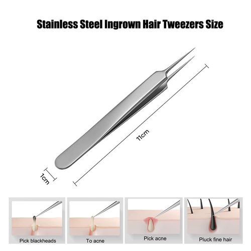 Stainless Steel Ingrown Hair Tweezer Fine Point Tweezer Professional Blackhead Whiteheads Splinter Remover Tweezer Precision Tweezer for Comedones Extractor Acne Eyebrow Hairs for Men and Women