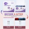 Wondfo 50 Ovulation Test Strips and 20 Pregnancy Test Strips Kit - Rapid Test Detection for Home Self-Checking (50 LH + 20 HCG)
