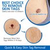 Uocasi Remover Device (Blue-2)
