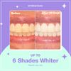 Smilesactives Teeth Whitening Pen - 3 Pack, Vanilla Mint I Tooth Whitening Kit for Whiter Smile in 7 Days, Fast On-The-Go Teeth Whitener Pen for Clinical-Grade Long-Lasting Stain Removal
