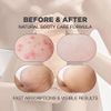Butt Scrub Wash | Booty Scrub Body Exfoliator for Acne, Cellulite, Ingrown Hair, Bikini & Razor Bump | Exfoliating Body Scrub for Sensitive and All Skin Type | Body Scrub Exfoliator Formulated with Rosemary Extract, Centella Asiatica, and Other Natural In