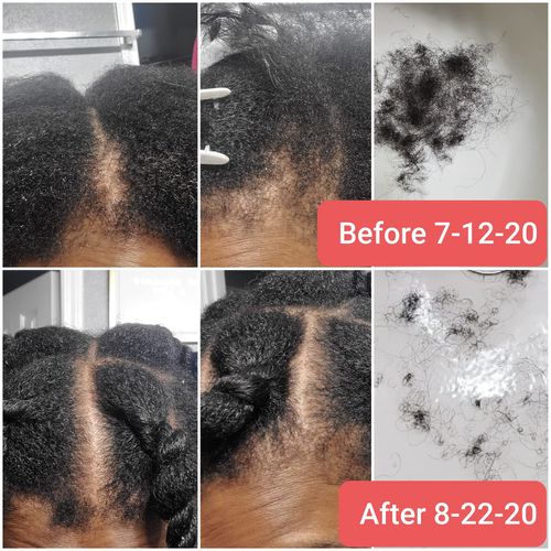 Silk Growth Oil is formulated with 6 organic essential oils which provide for 'RAPID' hair growth, it makes the hair shiny with a healthy glow and provides strength, luster, maintains PH balance, repairs dead skin cells and gives more elasticity to the ha