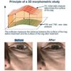 EYELISS® PEPTIDE EYE BAGS REMOVER