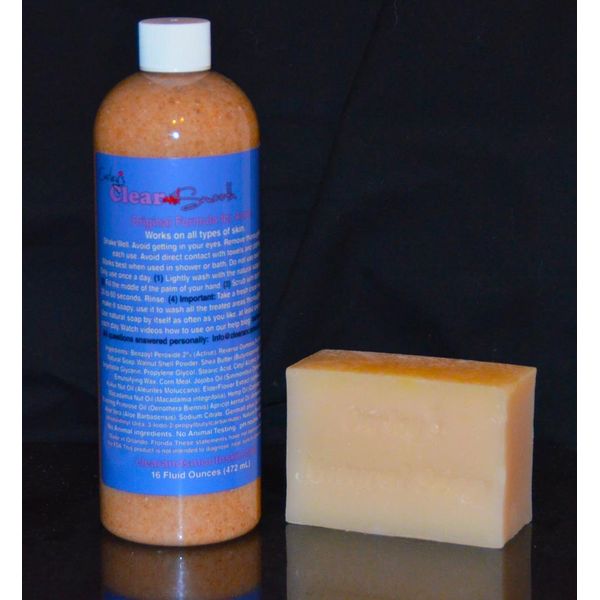 Carley's Clear & Smooth Acne Treatment for Adults#