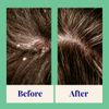 The Powder Shampoo - For Dandruff 20g Mini Refillable Bottle