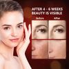 Red Light Therapy for Face, LED Red Light Therapy 660nm & 850nm Wavelength for Home Use …