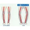 inso-rupuro Leg Protection "