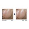RoC®️ Derm Correxion®️ Contour Cream 50ml