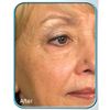 Sta-Tight Stem Cell Therapy 2-pack