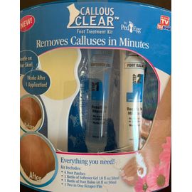 Callous Clear Foot Treatment Kit - Removes Calluses in Minutes