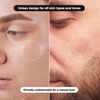 LE GUSHE Acne Pimple Master Patch 132 dots - Absorbing Hydrocolloid Blemish Spot Skin Treatment and Care Dressing