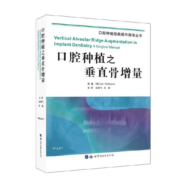 口腔种植之垂直骨增量