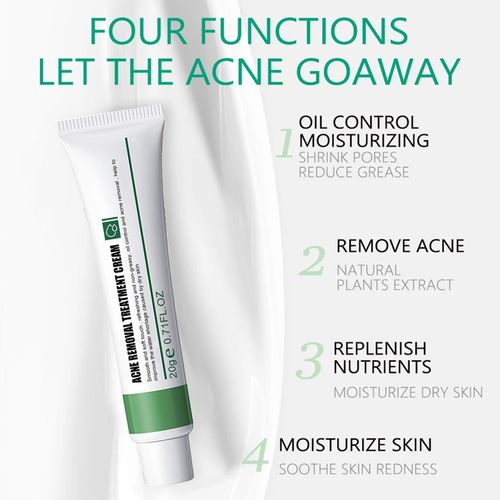 Anti Acne Face Cream, Spot Cream for Acne Treatment and Spot Treatment with Nicotinamide, Sodium Hyaluronate, Aloe, for Blackheads and Acne Prone Skin, Reduces Spot Size, Redness and Inflammation