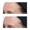 Perricone MD High Potency Classics: Hyaluronic Intensive Moisturizer 1 Fl Oz (Pack of 1)