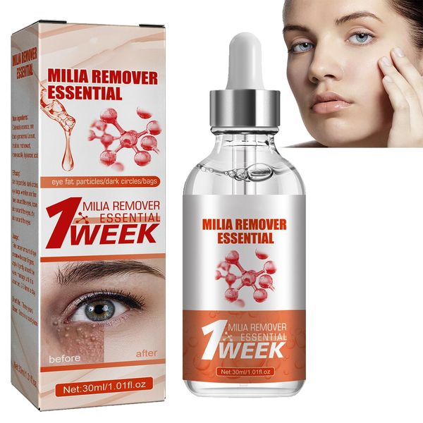 KOAHDE Milia Removal Face Serums,Milia Spot Treatment,Milia Treatment Spot Remover for Face,Speedy Milia Remover,Milia Spot Ruduce Face Serums,Dark Spot Remover Face Serum,Milia Removal Spot Care