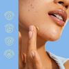 BYOMA Blemish Clearing Paste