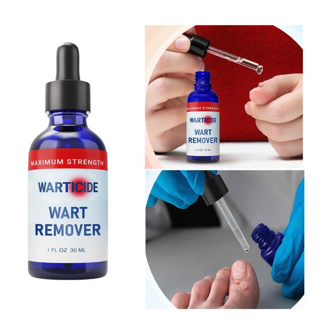 WARTICIDE Fast-Acting Wart Remover - Plantar and Genital Warts 1 Bottle