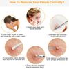 7PC Blackhead Acne Comedone Pimple Blemish Extractor Stainless Remover Tool Kit