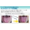 centrair tongue beauty