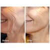 Skin Booster Hyaluronic Acid Authentic
