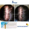 Restructuring Solution for Hair Growth Dermocosmetic Serum Mesotherapy De Nova