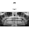 JVC [VINYL]