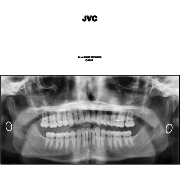 JVC [VINYL]