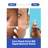 Olive Young Care Plus Spot Patch 1 Pack | Hydrocolloid Acne Korean Spot Patch to Cover Zits, Pimples and Blemishes, for Troubled Skin and Face (102 Count - 10mm*72ea + 12mm*30ea)