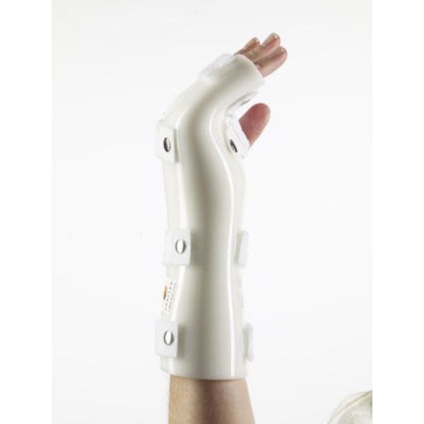Corflex POLYCAST EXTENDED BOXER SPLINT SMALL RIGHT Wrist 4-5", MCP 2.75-3.25"
