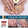 Fungal Nail Treatment for Toenails Extra Strong, Toenail Fungus Treatment Nail Repair for Fingernails Toenails, Toe Nail Fungal Treatment Fungal Nail Solution Fixes Nails Safe Effective (50ML)