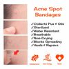 EXTRA LARGE/JUMBO Dots For Large Acne Zits, Boils, Larger Spot Patches PLAIN