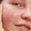 The INKEY List Glycolic Acid 100ml