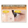Medicated tubu・naito K