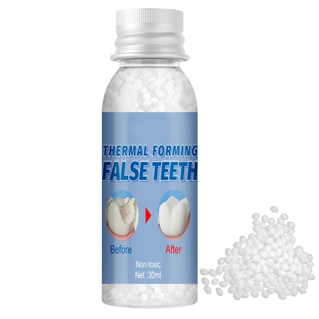  Tooth Repair Kit - Temporary Tooth Filling, Fake Teeth  Replacement Kit Tooth Repair Beads Moldable False Teeth, Ideal for Missing  Broken Tooth and Gaps (30ml) : Health & Household