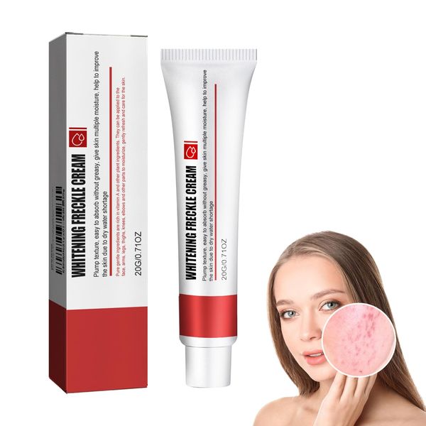 Pigment Spot Cream, Anti Pimple Cream Anti-Acne Anti-Pigmentation Cream Brightening Freckle Cream For Freckles Acne Freckle Removal Cream, Whitening Freckles Cream For Dark Spot Remover, Acne Removal