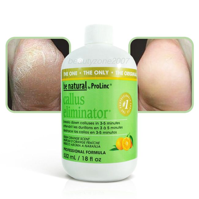 Prolinc Be Natural Callus Eliminator Pedicure 18oz - Orange